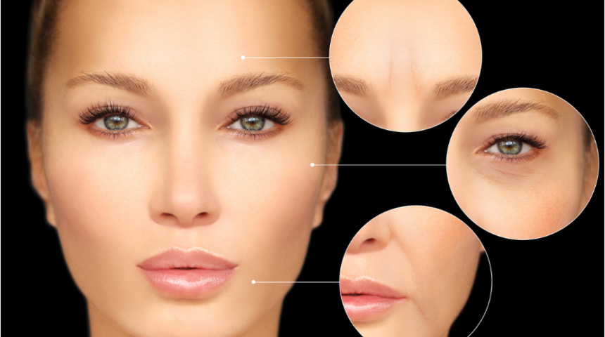 Baby botoks nedir, avantajları nelerdir?