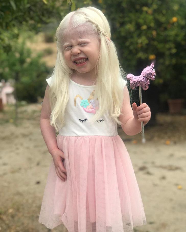 Esmer çift, beyaz tenli ve sarı saçlı bebeklerini görünce şoke oldular! G5