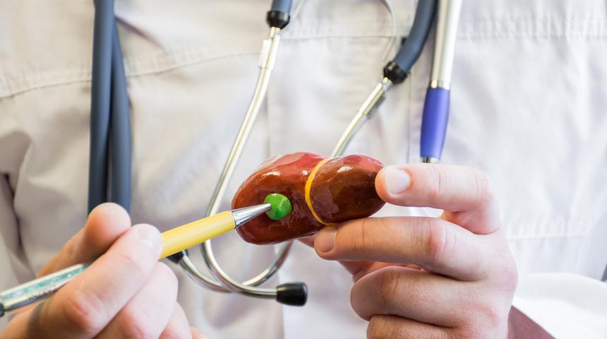 Safra kesesinden 200 taş çıkarıldı