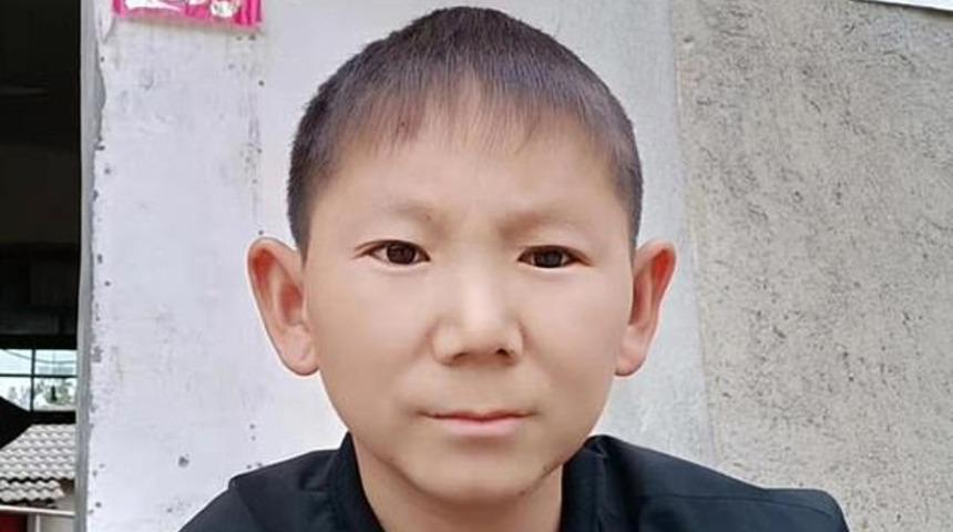 6 yaşında kafasına darbe aldı, 34 yaşında aynı kaldı!