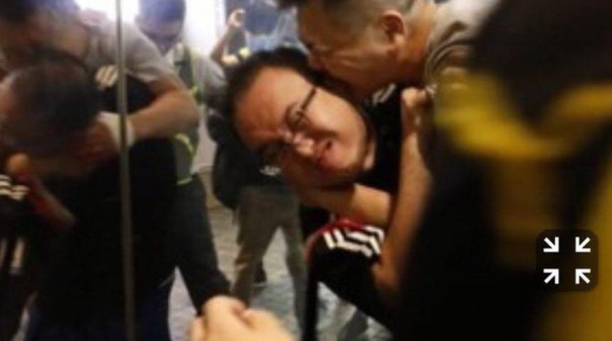 Hong Kong'da şoke eden olay! Bıçaklı saldırgan, bir siyasetçinin kulağını ısırarak kopardı