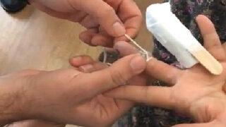 Parmağına sıkışan yüzüğü itfaiye eri saniyeler içinde çıkardı