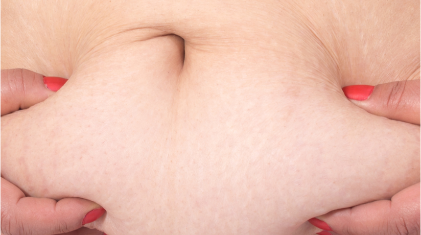 Kimler karın germe ameliyatı yaptırabilir?