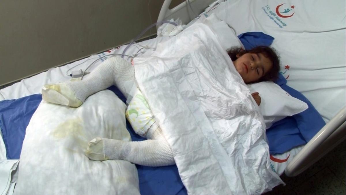 Korkun&ccedil; olay! Oyun oynarken tandıra d&uuml;şen &ccedil;ocuk feci şekilde yandı