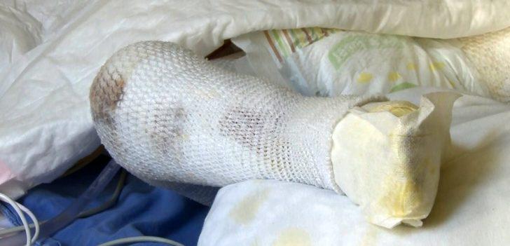 Korkunç olay! Oyun oynarken tandıra düşen çocuk feci şekilde yandı G5