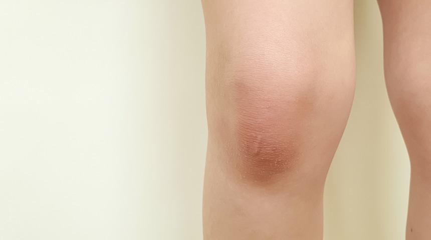 Dizden gelen &ccedil;ıtlama veya &ccedil;atırdama sesleri hakkında bilinmesi gerekenler