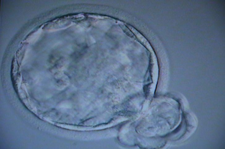 Menopozlu kadınları umutlandıran kök hücre nakli G3