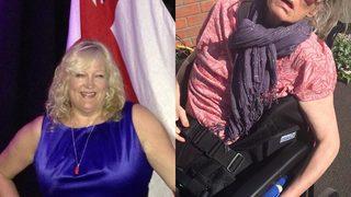 Demans hastalığı eşini bu hale getirdi!