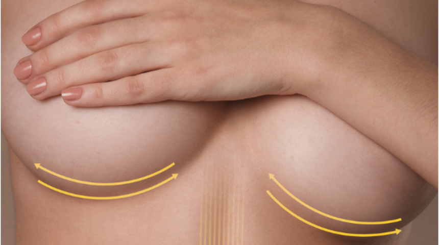 Tek seferde birden çok estetik yaptırılabilir mi?