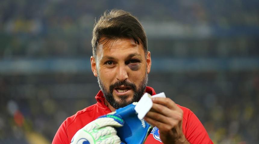 Ramazan Köse’nin gözündeki morluk dikkat çekti