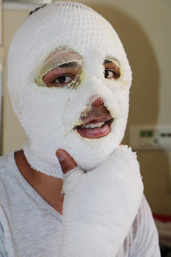 Arkadaşı sobaya tiner dökünce bu hale geldi! 'Her yer alevlerle kaplandı' G1