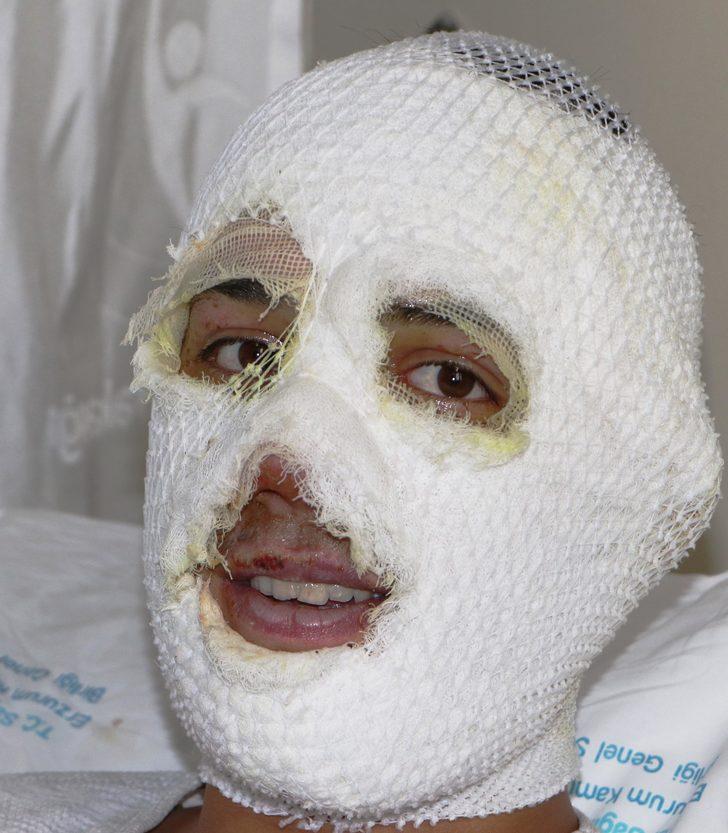 Arkadaşı sobaya tiner dökünce bu hale geldi! 'Her yer alevlerle kaplandı' G2