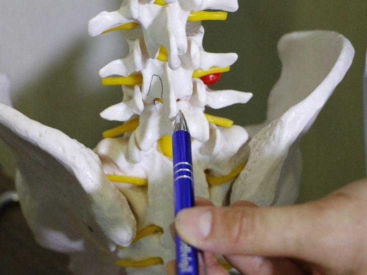 Bel fıtığı tedavisinde tam kapalı cerrahi yöntemi konfor sağlıyor G2