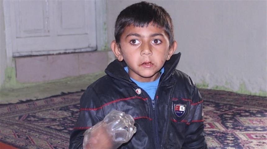 Ellerini ısıran çocuk, İzmir'de tedavi altına alındı