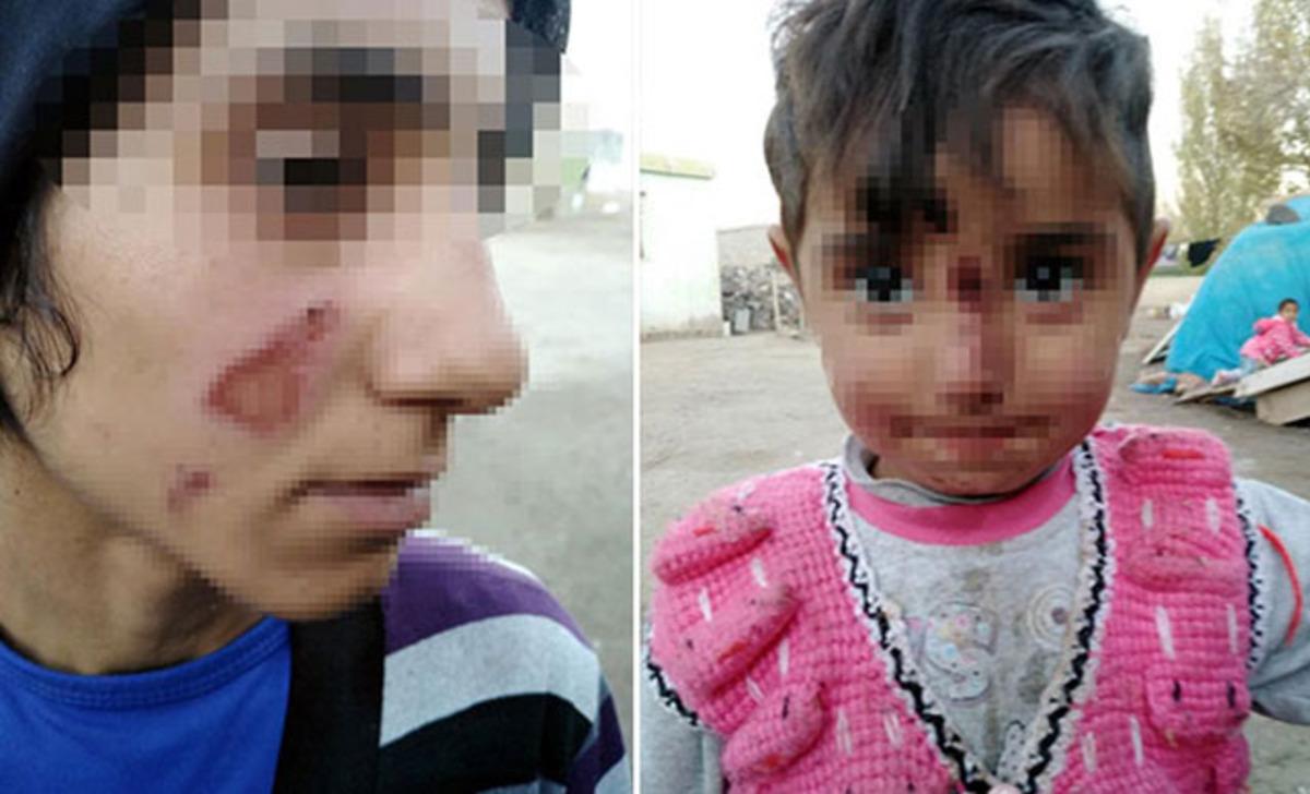 Ağrı'da eşinin ve kızının y&uuml;z&uuml;n&uuml; naylon poşet eritip yakan kişi tutuklandı