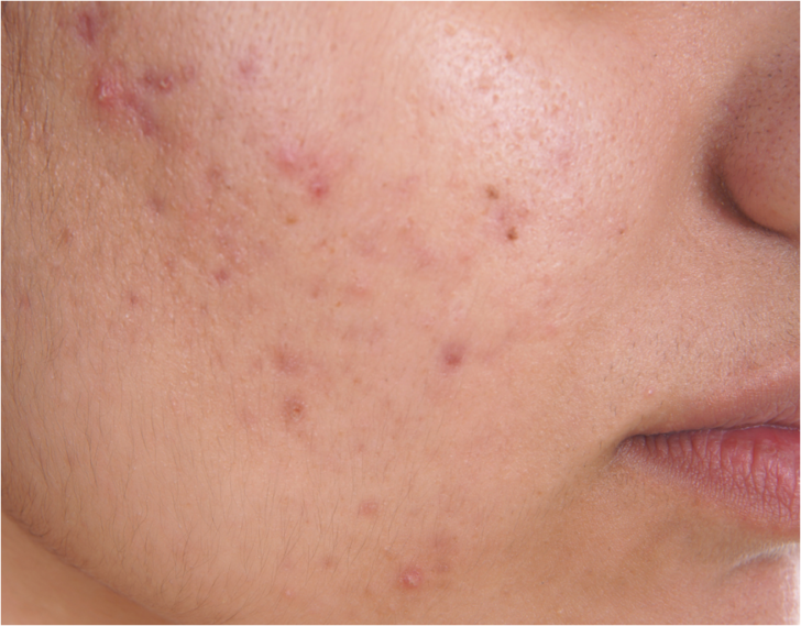 Dermatologlar önermiyor! Bu ürünleri hepimiz kullanıyoruz ancak onlar kara listede  G5