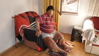 Fil hastası adamın hali yürek dağladı: Dayanacak gücüm kalmadı