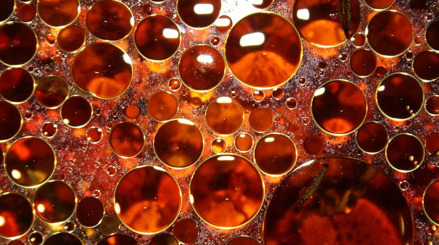 Uzmanlardan "Trans yağ sağlığı tehdit ediyor" uyarısı