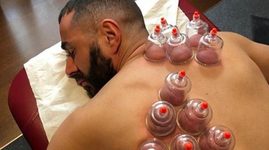 Yıldız futbolcu hacamat yaptırdı!