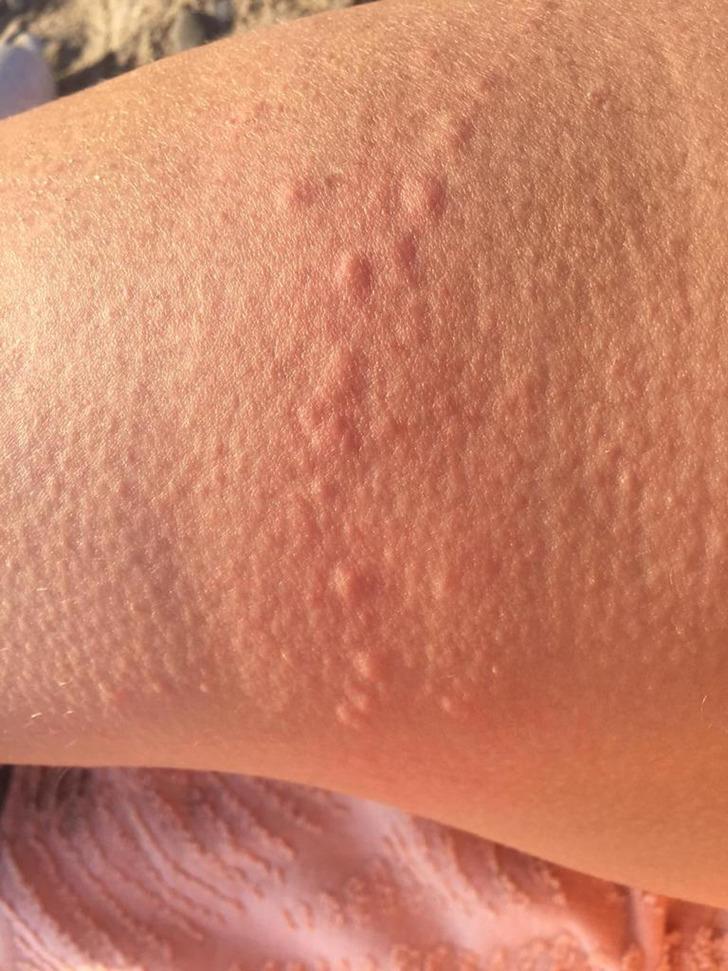 Denizde elektrik değil knidiler çarpıyor! G4