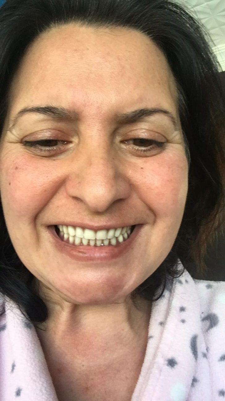 'Delirten hastalık' yüzünden çok zor günler geçirmişti! Bu kez de unutkanlıktan şikayetçi G1