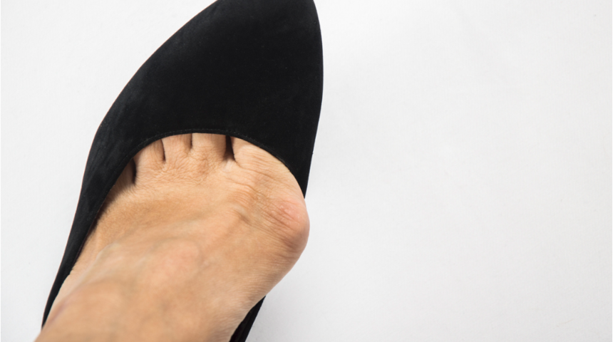 Ayağı vuran ayakkabı giymekten ve pedik&uuml;rden ka&ccedil;ının