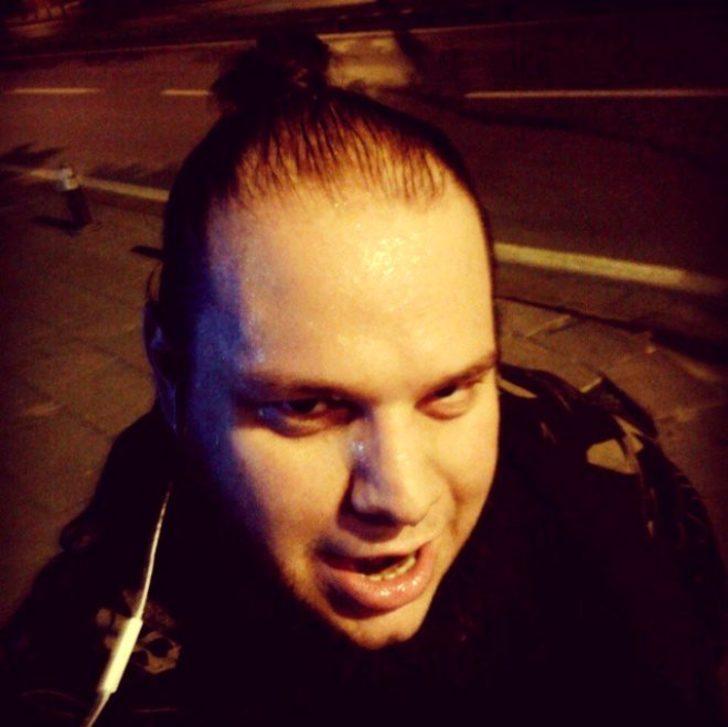 O Ses Türkiye yarışmacısının müthiş değişimi! 123 kilo verdi G5