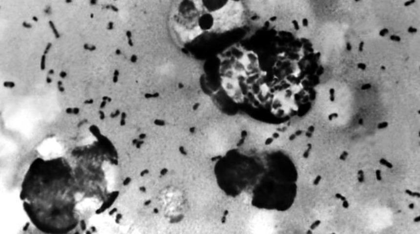 &Ccedil;in'de iki kişide veba g&ouml;r&uuml;ld&uuml;