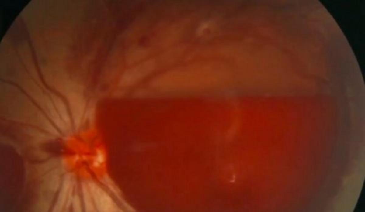 Telefonunu bilin&ccedil;sizce kullanınca k&ouml;r oldu!