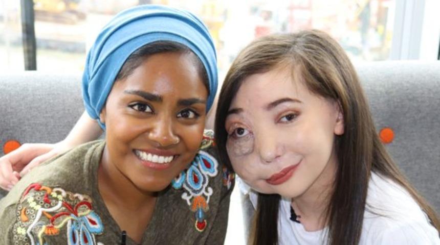 Arteriyovenöz malformasyon hastası olan genç, özgüvenini YouTube ile kazandı!