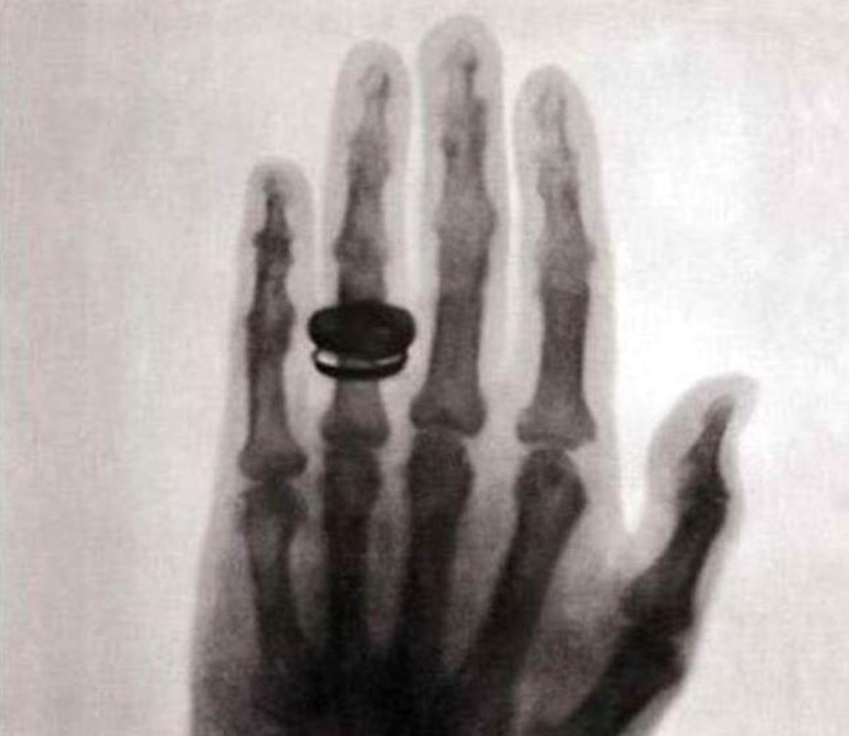 &Ccedil;ekilen ilk r&ouml;ntgen filmindeki ilgin&ccedil; detay!