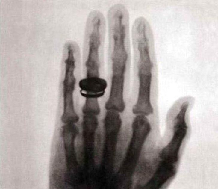 Çekilen ilk röntgen filmindeki ilginç detay! G1