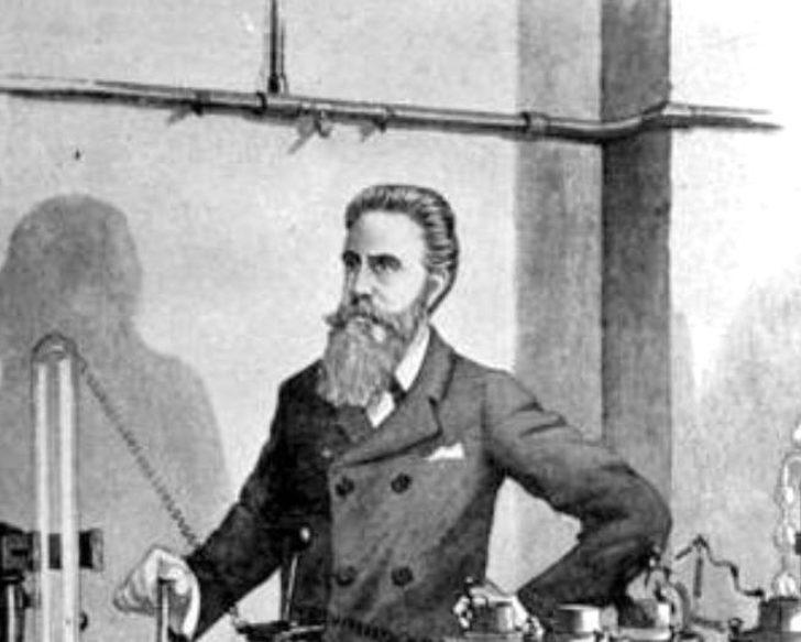 Çekilen ilk röntgen filmindeki ilginç detay! G2