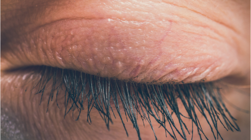 Göz kapaklarınız sarkıyorsa nedeni yorgunluk olabilir