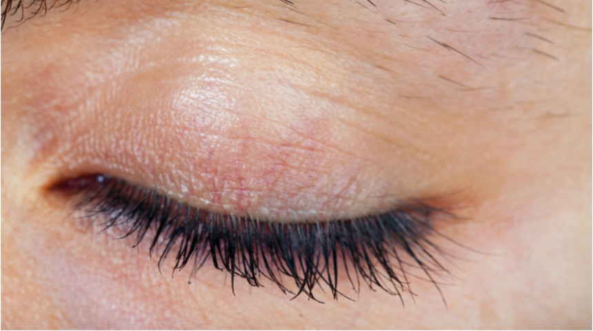 Takma kirpik kullanan kadınlar kirpik biti riskiyle karşı karşıya