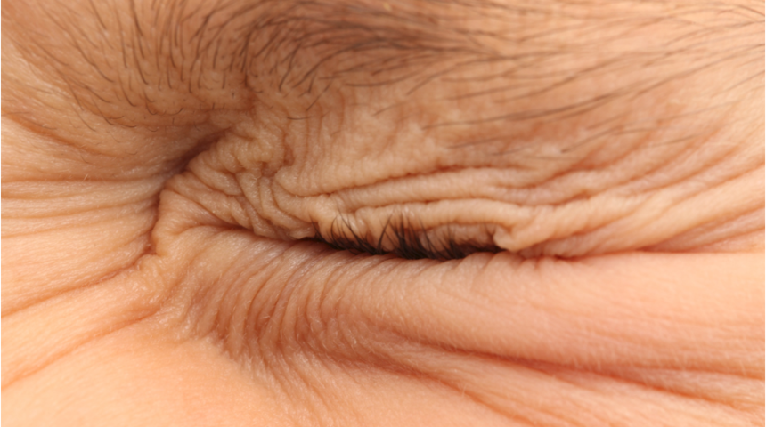 Göz çevresindeki kırışıklıklara karşı 4 altın ipucu  