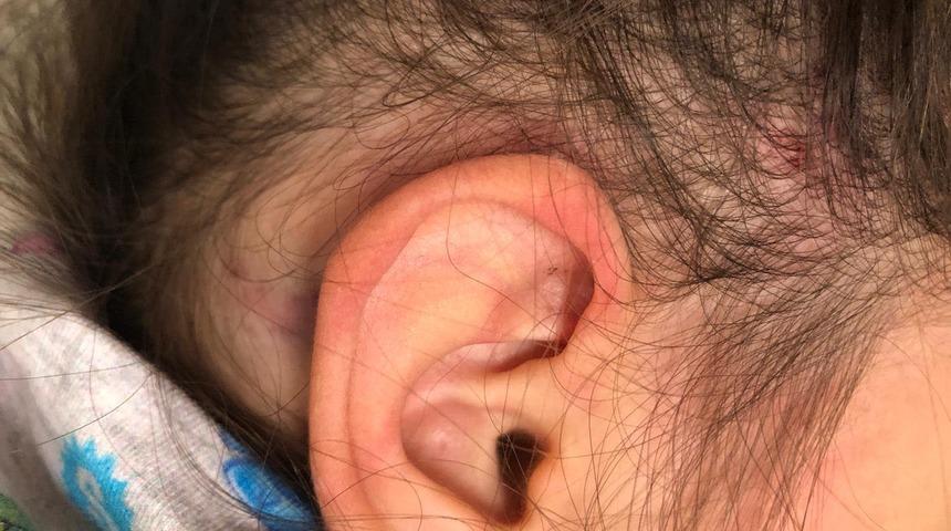 Korkun&ccedil; olay! 2.5 yaşındaki &ccedil;ocuk, sınıf arkadaşları tarafından d&ouml;v&uuml;ld&uuml;