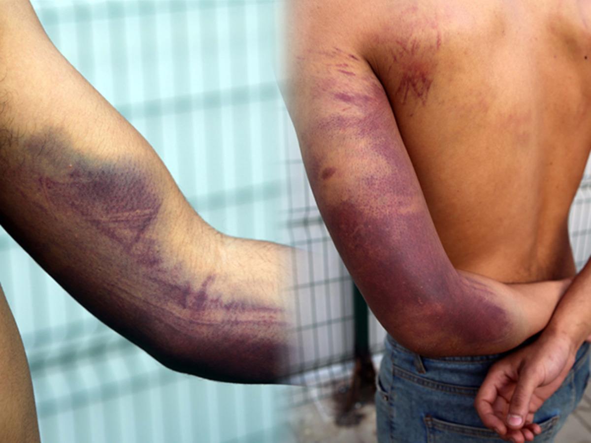 Yunan askerleri 'darp etti' iddiası! Sınırda bulundular