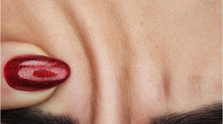 Botoks kırışıklıklar derinleşmeden yapılmalı