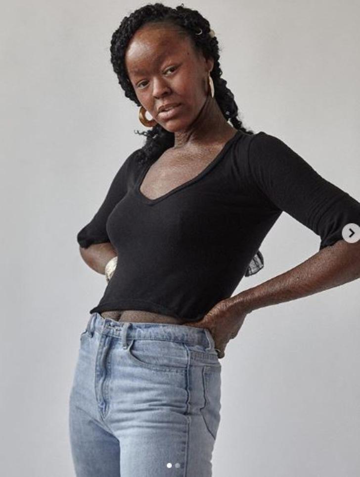 İki haftada bir deri değiştiriyor! Jeyza Gary dünyaya ilham oldu  G5