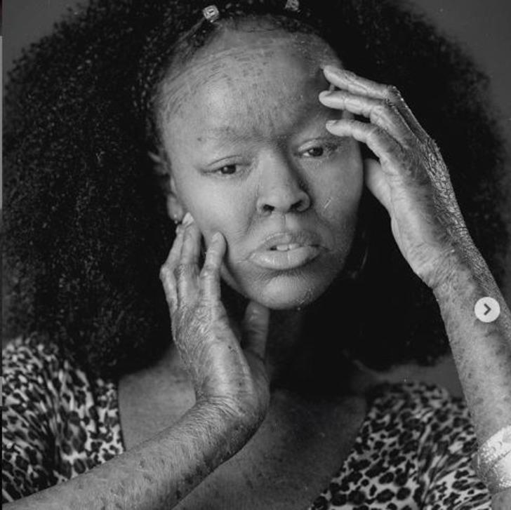 İki haftada bir deri değiştiriyor! Jeyza Gary dünyaya ilham oldu  G3