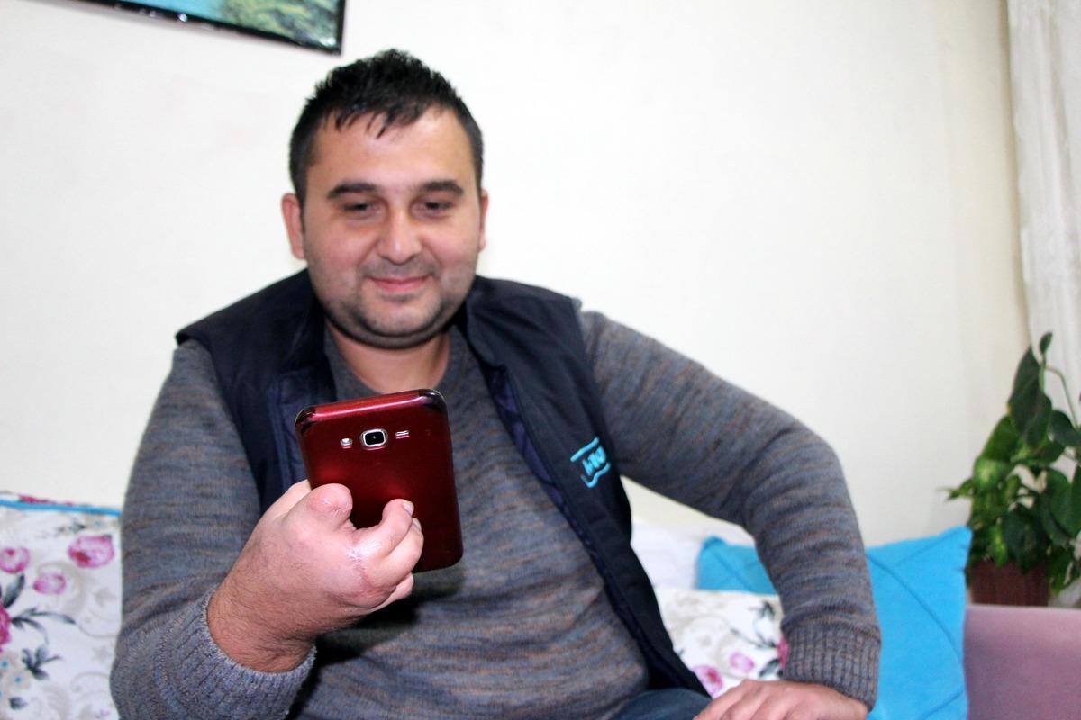 Ayak parmakları eline dikildi: D&uuml;nyaya yeniden gelmiş gibiyim