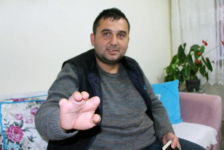 Ayak parmakları eline dikildi: Dünyaya yeniden gelmiş gibiyim G3