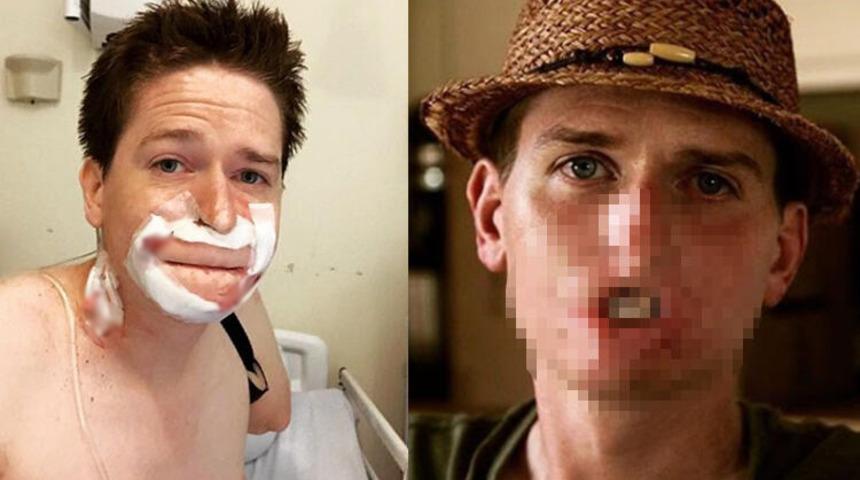 Hastalığını ciddiye almadı! Ağzını yemeye başladı!