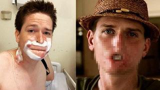 Hastalığını ciddiye almadı! Ağzını yemeye başladı!