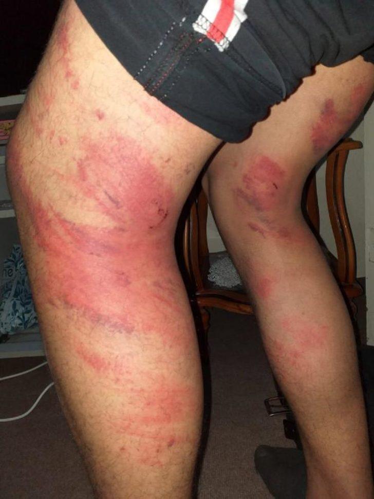 'Triger kayışı' dehşetinde şaşkına çeviren gelişme G2