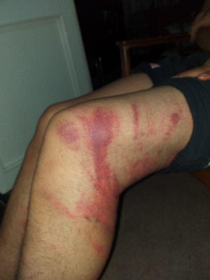 'Triger kayışı' dehşetinde şaşkına çeviren gelişme G3