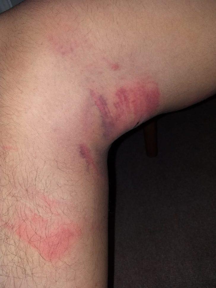 'Triger kayışı' dehşetinde şaşkına çeviren gelişme G4