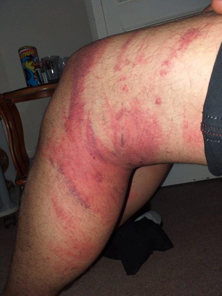 'Triger kayışı' dehşetinde şaşkına çeviren gelişme G5