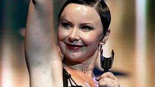 Saçlarıyla alay ettiler ama...